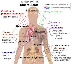 HEREDITY AND TUBERCULOSIS